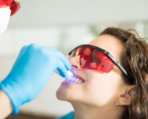 SOS Wax in Las Vegas - SOS Wax in Las Vegas - L.E.D Teeth Whitening Service