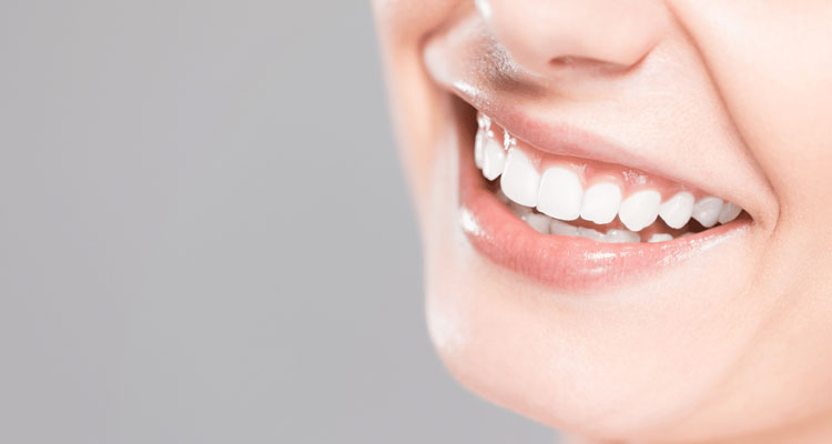 SOS Wax in Las Vegas Teeth Whitening